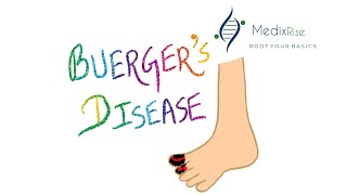 Buerger’s disease  Medixrise  For Medical students InTheNutShell [upl. by Anaitak]