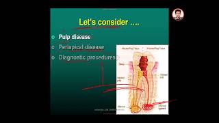 endodontic lecture 2  pulp and periapical pathosis part 1 [upl. by Claudetta]