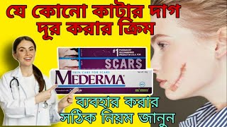 Mederma cream  mederma cream for acne scars  mederma cream review  mederma scar cream [upl. by Merrily306]