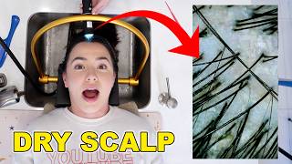 Trying The Viral Scalp Spa  Merrell Twins [upl. by Hnirt962]