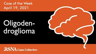 Case of the Week Oligodendroglioma [upl. by Honeyman]