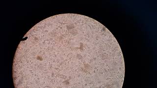 Hnana  Hymenolepis nana  Microscopic Examination Of Human Feces  Stool RE  Parasite [upl. by Onifled]