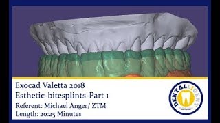 Dentalligent  ExocadValetta2018estheticbitesplintsPart1  PREVIEW [upl. by Ocinom]