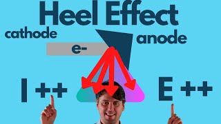 Heel Effect Complete Physics Guide Radiologic Technologists [upl. by Ela]