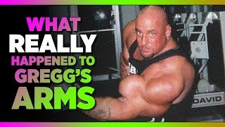 What Do Gregg’s Arms Look Like Now  Storytime With Gregg Valentino [upl. by Kenward]