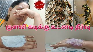 குளவி கடிக்கு உடனடி தீர்வுபூச்சி கடிDD Lifestyle [upl. by Enileda]