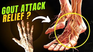 Gout Attack Relief Top 10 Uric AcidBUSTING Foods ✅ [upl. by Aneger]