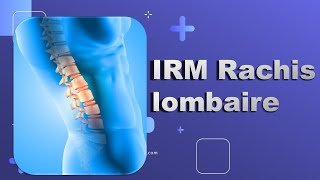 IRM du Rachis lombaire Bonne Pratique [upl. by Lamar]