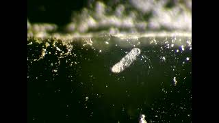 Protists and a bdelloid  rotifer  Raw vid II [upl. by Ccasi]