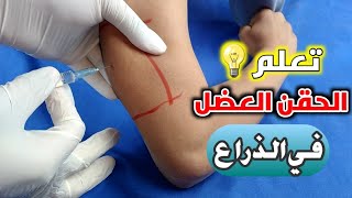 تعلم اعطاء الحقن العضل في الذراع بدلا من المؤخرهLearn to give the im injection in the arm [upl. by Jeremiah]