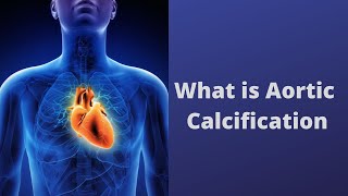 What is Aortic Calcification [upl. by Imrots]