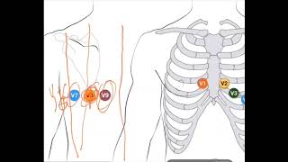 ECG 18 DÉRIVATIONS [upl. by Herstein]