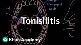 Tonsillitis  Respiratory system diseases  NCLEXRN  Khan Academy [upl. by Nilrac]