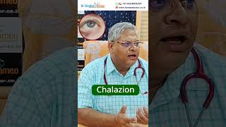 Homeopathic Treatment for Chalazion shorts chalazion homeodoctor [upl. by Enirehtacyram]