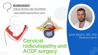 Cervical disc herniation [upl. by Newkirk]