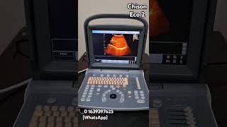 Portable Colour Ultrasound  Eco 2  Chison Chison Eco2 [upl. by Eenahc]