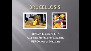 Brucellosis Causes and effects DrRakha [upl. by Orban]