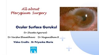 All about Pterygium SurgeryAnimated [upl. by Jehiel]