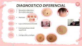 Queratosis Actinica Mabel Carolina Fernandez Alanes 25847 [upl. by Lajib]