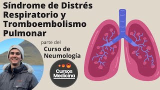 Síndrome de Distrés Respiratorio y Tromboembolismo Pulmonar [upl. by Navi177]