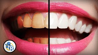 Whats The Best Way To Whiten Teeth [upl. by Klecka868]