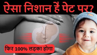 पेट पर ये निशान हो तो लड़का होने की निशानी है  Signs of a Baby Boy Based on Belly Marks [upl. by Casia]