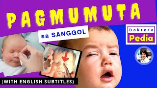 PAGMUMUTA sa SANGGOL  NAGMUMUTA ang mga MATA ni BABY  DOKTORA PEDIA [upl. by Okiram308]