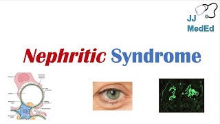 Nephritic Syndrome  Clinical Presentation Causes and Treatment [upl. by Onin]