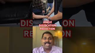 Ankle dislocation reduction [upl. by Lower]