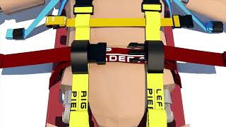 Octopus Rescue System Secure and Efficient Immobilization for Emergencies [upl. by Einwahs]