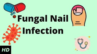 Fungal Nail Infection Causes Signs and Symptoms Diagnosis and Treatment [upl. by Niltac]