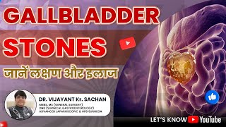 Gallbladder Stones Disease Symptoms amp Treatment  Dr Vijayant Sachan [upl. by Kirimia]