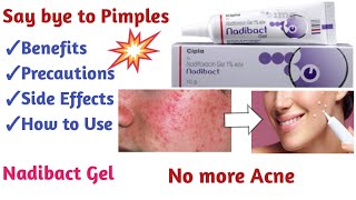 How to get rid of Pimples or acne Nadibact cream review [upl. by Hurlbut97]