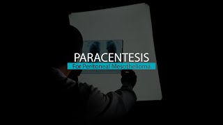 Paracentesis for Peritoneal Mesothelioma  Mesothelioma Hope [upl. by Erdnaxela259]