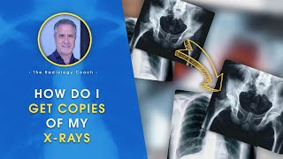 HOW do I GET COPIES of MY XRAYS [upl. by Werby]