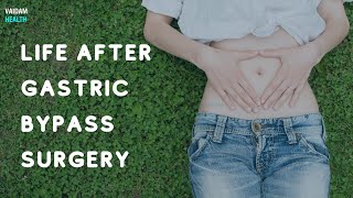 Life After Gastric Bypass Surgery [upl. by Ayadahs]