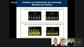 CardioImagen  Disfunción Diastolica [upl. by Enaamuj]