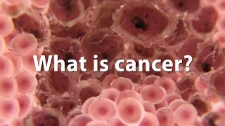 What is cancer What causes cancer and how is it treated UPDATE [upl. by Itraa]