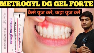 metrogyl dg gel forte metrogyl dg gel forte uses in hindi metrogyl dg gel forte how to apply [upl. by Enahpad]