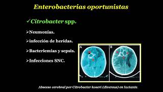 Enterobacterias oportunistas Acinetobacter spp [upl. by Lanta]