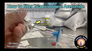 CataractCoach™ 1664 how to filter triamcinolone acetonide Kenalog [upl. by Elleoj896]