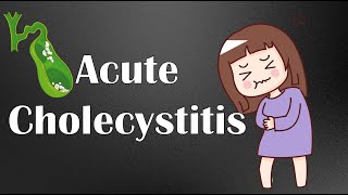 Acute Cholecystitis  Causes Symptoms Physical Signs Diagnosis amp Treatment [upl. by Guild11]