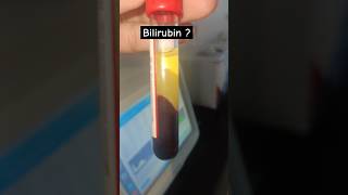 Bilirubin kitna hailab technologist status labstatus shorts pathology bloodtest scienceaiims [upl. by Ahseinar]