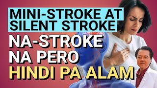 MiniStroke at Silent StrokeNaStroke na Pero Hindi Pa Alam  By Doc Willie Ong [upl. by Boycey167]