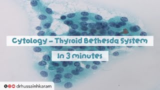 Cytology  Thyroid Bethesda System of Reporting in 3 minutes [upl. by Daahsar36]