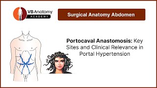 Portocaval Anastomosis Key Sites and Clinical Relevance in Portal Hypertension [upl. by Alekim]