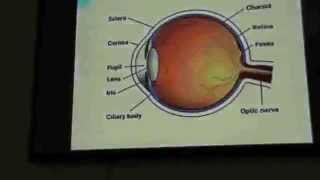 Ophthalomology  DrMohamed Khfagy  Errors of Refraction  Part 1 [upl. by Trebuh]