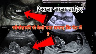 how to read sonographypregnancy ultrasound report kaise dekhe [upl. by Alica]