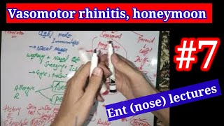 vasomotor rhinitis Honeymoon rhinitis 🔴 ENT NOSE LECTURES 7 vasomotor rhinitis entlectures [upl. by Ednew]