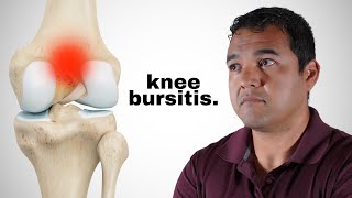 Knee Bursitis Causes Symptoms and Treatment Options [upl. by Nai]